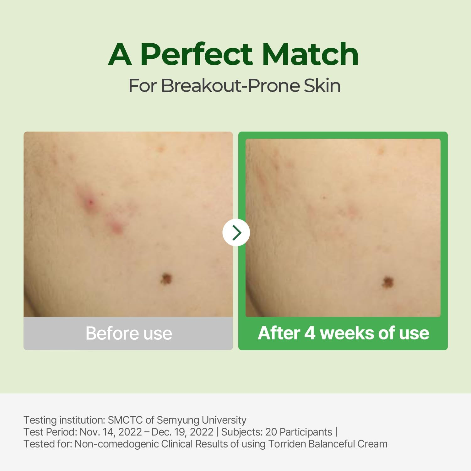 Torriden BALANCEFUL Cream 80Ml (2.70 Fl.Oz.) | Soothing and Nourishing Moisturizer for Oily and Sensitive Skin | 5D CICA, Hydrolyzed Hyaluronic Acid, Panthenol image number 2