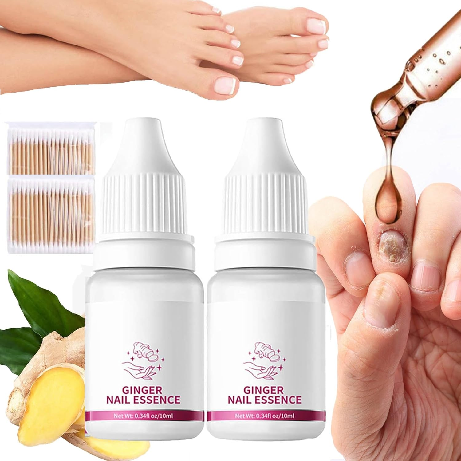 Fungigone Nail Treatment, Fungigone Nail Fungus Removal, 7 Days Nail Fungus Treatment for Toenail, Foot F-Ungus Treatments Nails Care Solution for Toenails & Fingernails (3 PC)