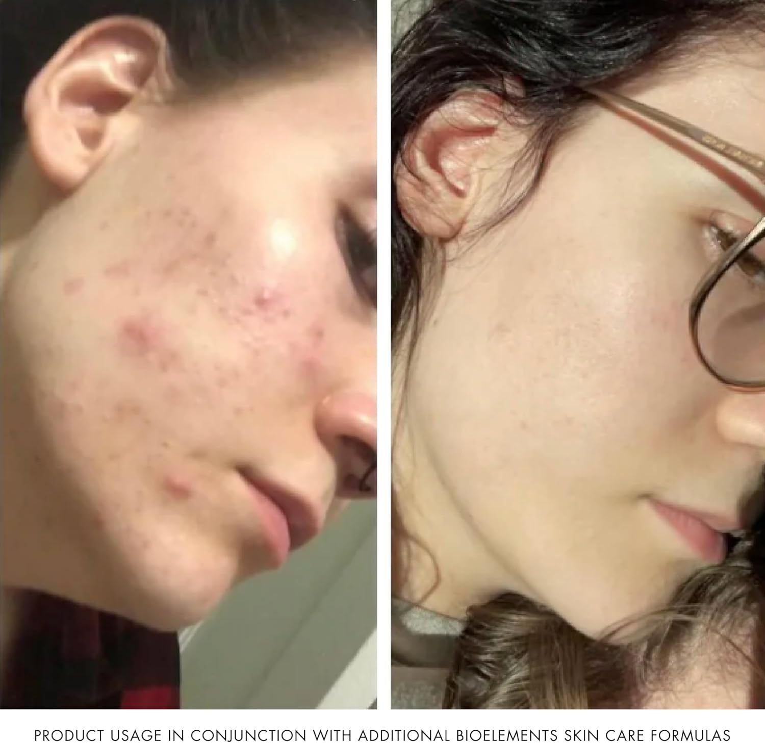 Bioelements Kerafole Facial Mask, 74Ml image number 2