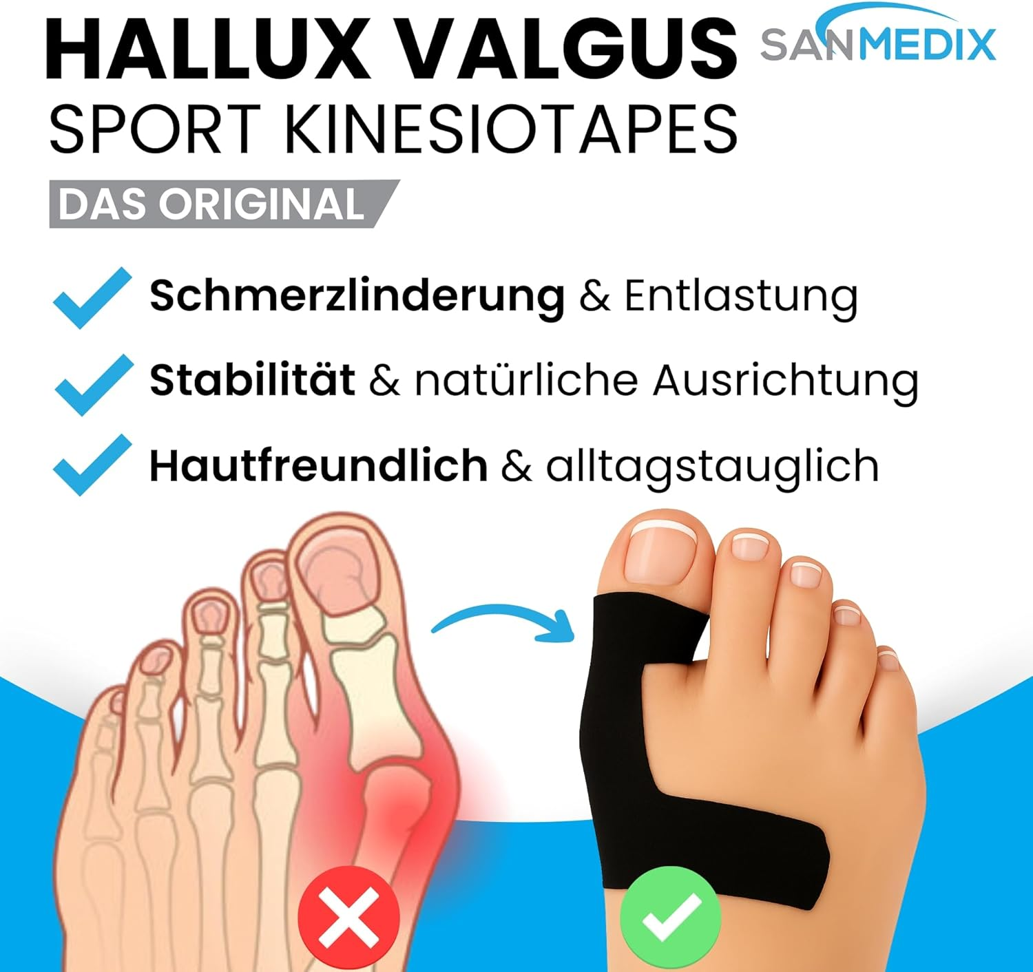 Hallux Valgus Kinesiology Tape - 20 Pre-Cut Sports & Physio Tapes for Toe and Foot - Precut Kinesiology Tape for Bunions, Skin Friendly and Latex-Free (Black + Blue, Pack of 20) image number 4