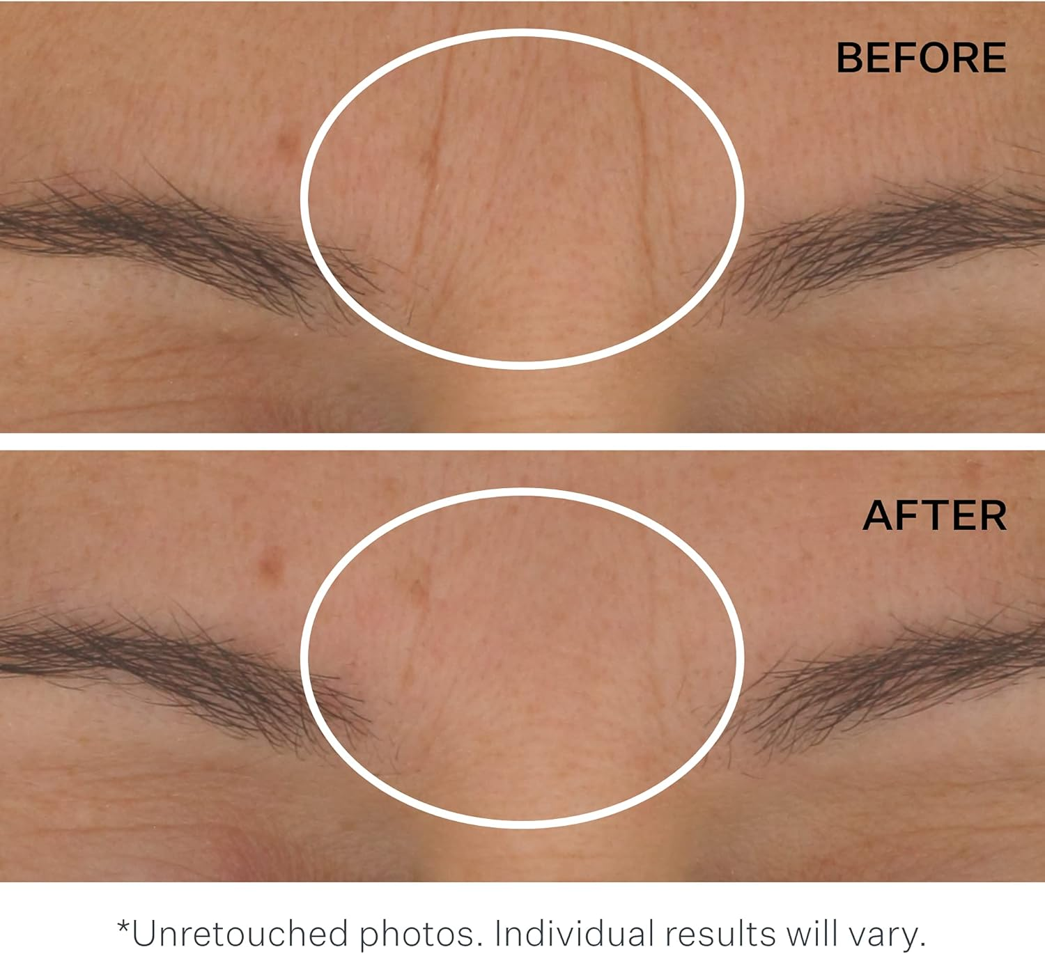 Strivectin Strivectin STAR Light Retinol Night Oil for Unisex 1 Oz Oil, 30 Ml image number 6