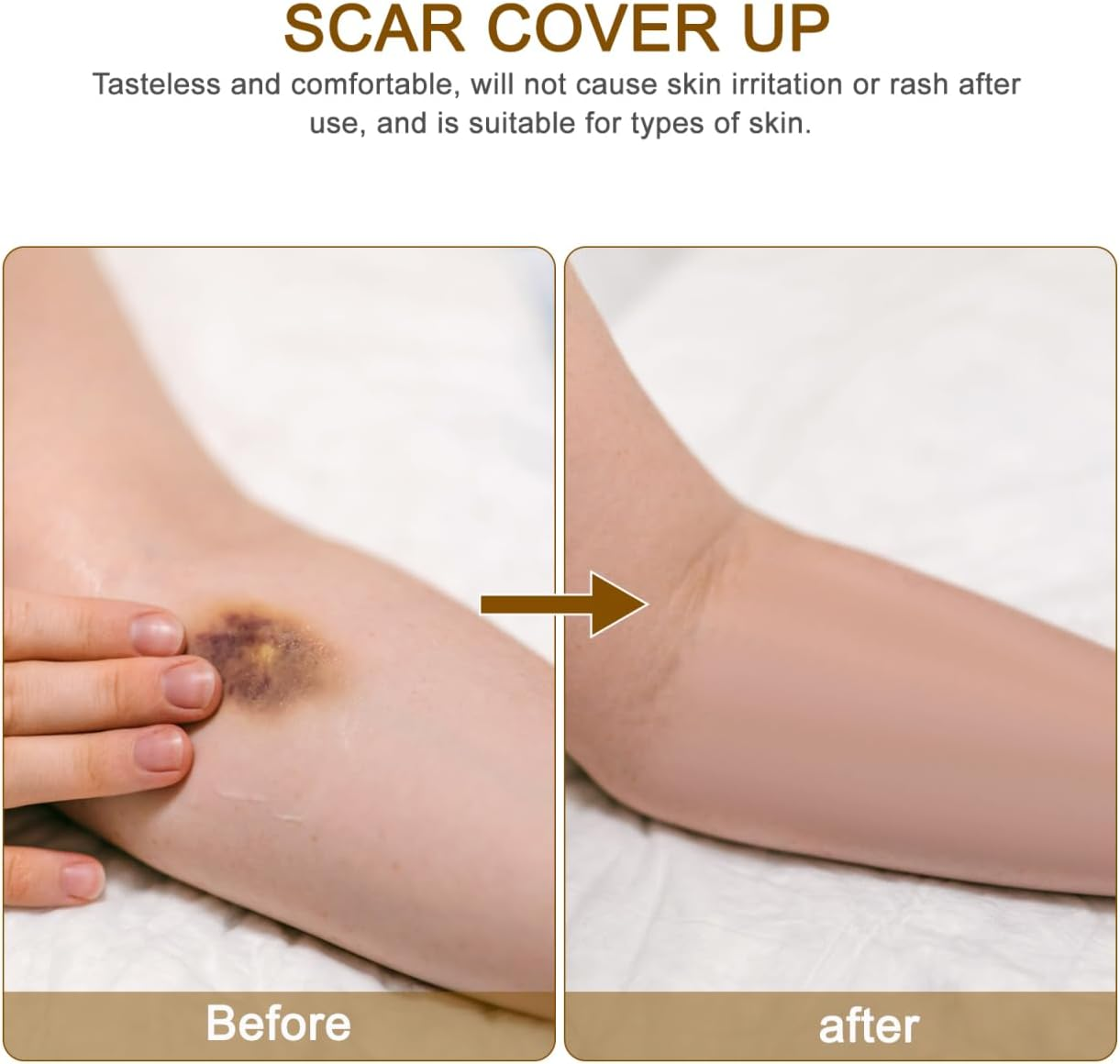 FOMIYES Waterproof Scar Concealer Tape, Invisible Skin Tone Cover up Patch for Tattoo, Scars, Birthmarks, Makeup Use - Complexion image number 3