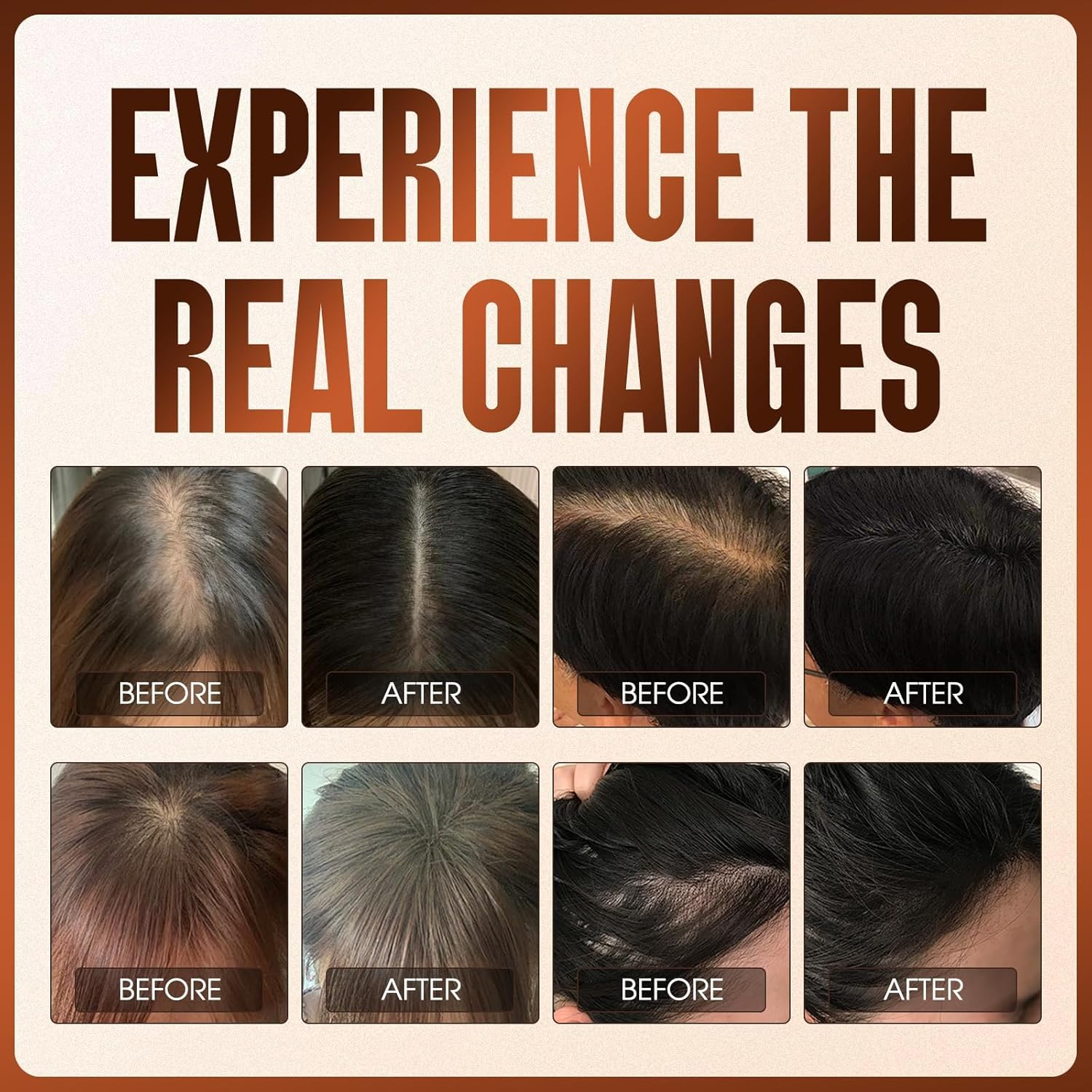 Herbs Boat Hair Growth Spray, Hair Growth Spray, with Biotin, Ginger Root Extract, He Shou Wu, Castor Oil, Reduced Shedding, Hydration and Silky Texture for Women & Men - 50Ml (1Pcs) image number 1