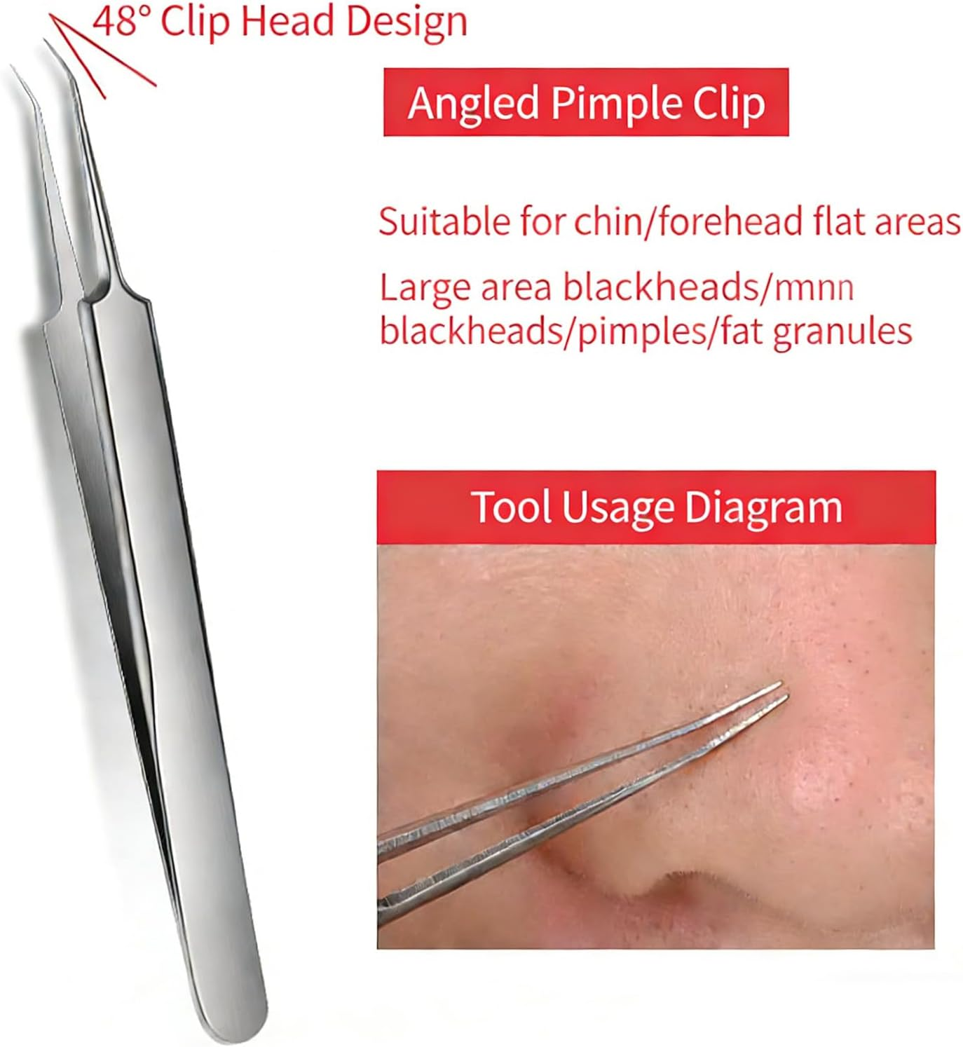 Luzcauwy Professional Facial Blackhead Remover Tweezers, Stainless Steel Acne Clip for Ingrown Hair Removal, Precision Blackhead Remover Tool and Pimple Popping Kit for Skin Care Use image number 3
