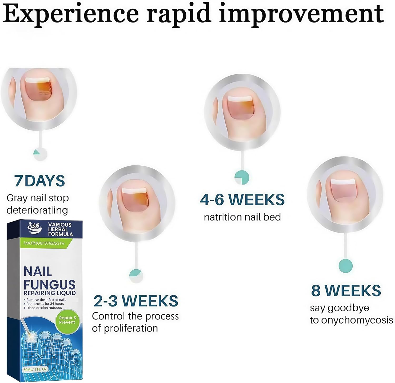 Fungal Nail Treatment - Fast-Acting Solution for Thick, Discolored Toenails &ndash; Revitalize Yellow & Brown Nails with Our Powerful Formula &ndash; Quick, Effective Relief for Beautiful Nails image number 2
