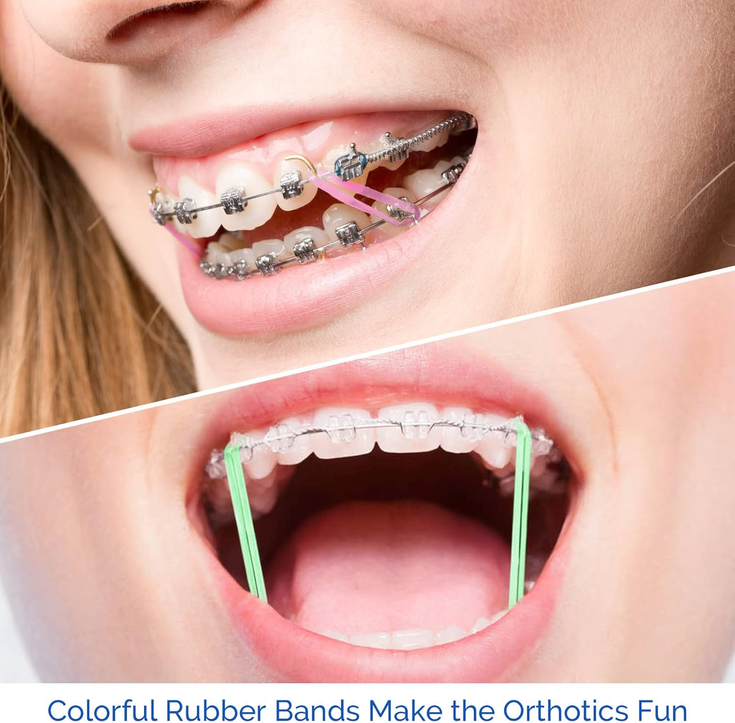 JMU Orthodontic Elastics 3/16 Heavy, 500 Pack Intraoral Rubber Bands Latex Free Dental Rubber Bands Made in USA image number 6