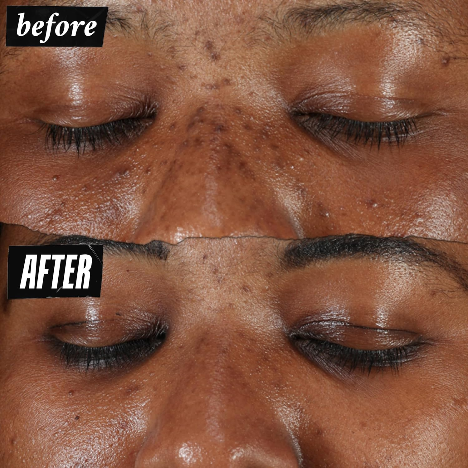 Kiehl'S Clearly Corrective Dark Spot Solution Facial Serum 100 Ml image number 6