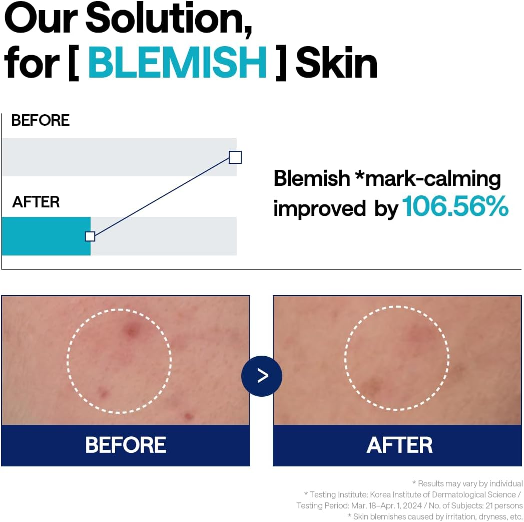 MEDIHEAL Madecassoside Repair Serum 1.35 Fl.Oz - Blemish Care, Fades Pigmentation and Freckles & Skin Soothing & Hydration - with Centella Asiatica, Niacinamide image number 3