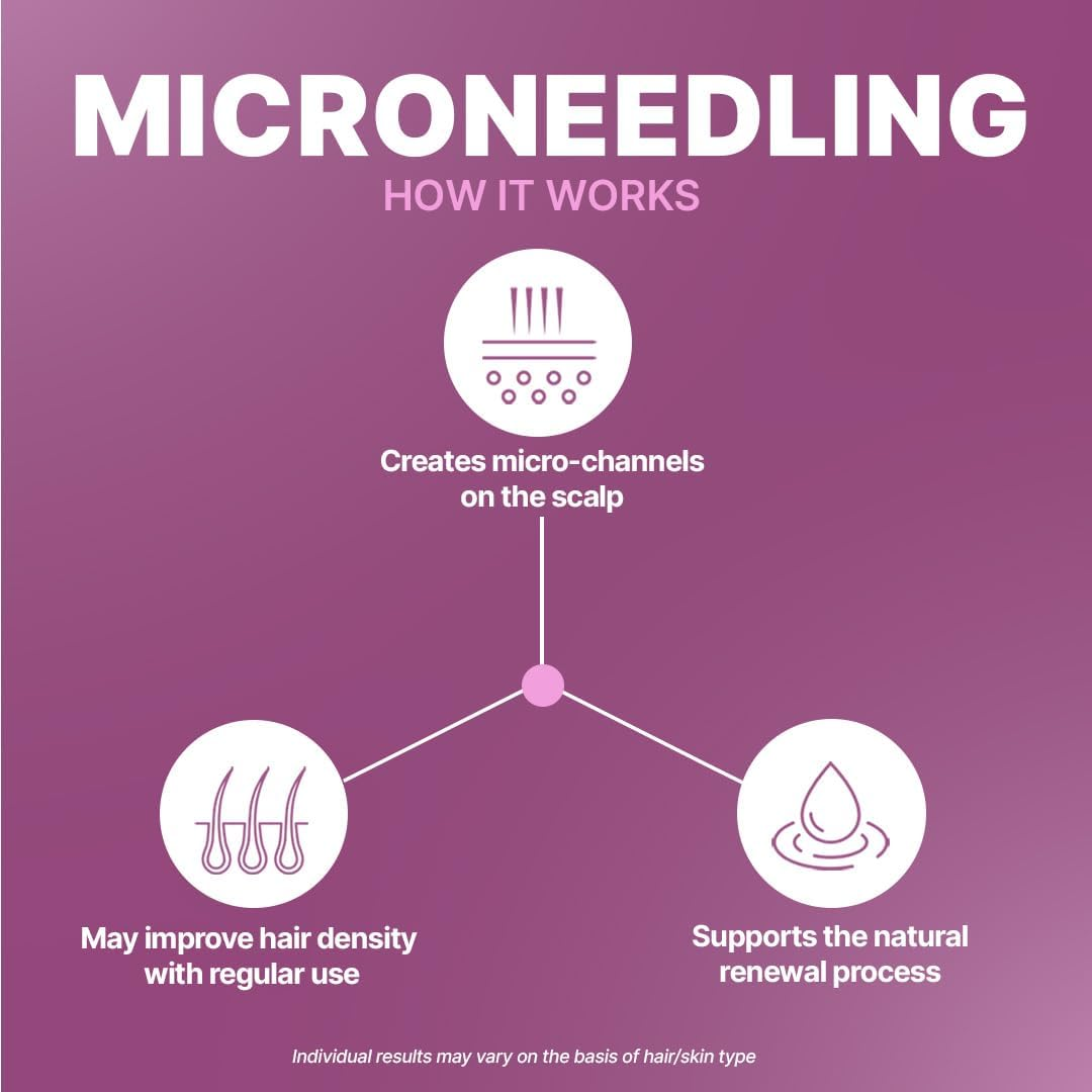 Sotrue Hair Growth Derma Roller 0.5 Mm with 540 Titanium Needles, Activates Hair Follicles, Repairs Damaged Hair, for Hair Fall & Hair Thickening, Reduces Acne Scars, Safe & Effective to Use image number 1