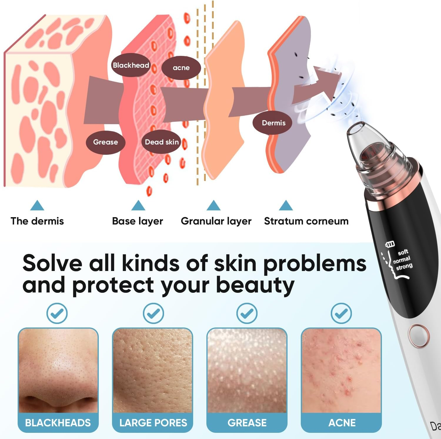 Blackhead Remover Pore Vacuum for Face & Nose &ndash; Deep Cleansing Blackhead Remover Tools with 3 Suction Levels, 5 Replaceable Tips, USB Rechargeable Pore Cleaner image number 4