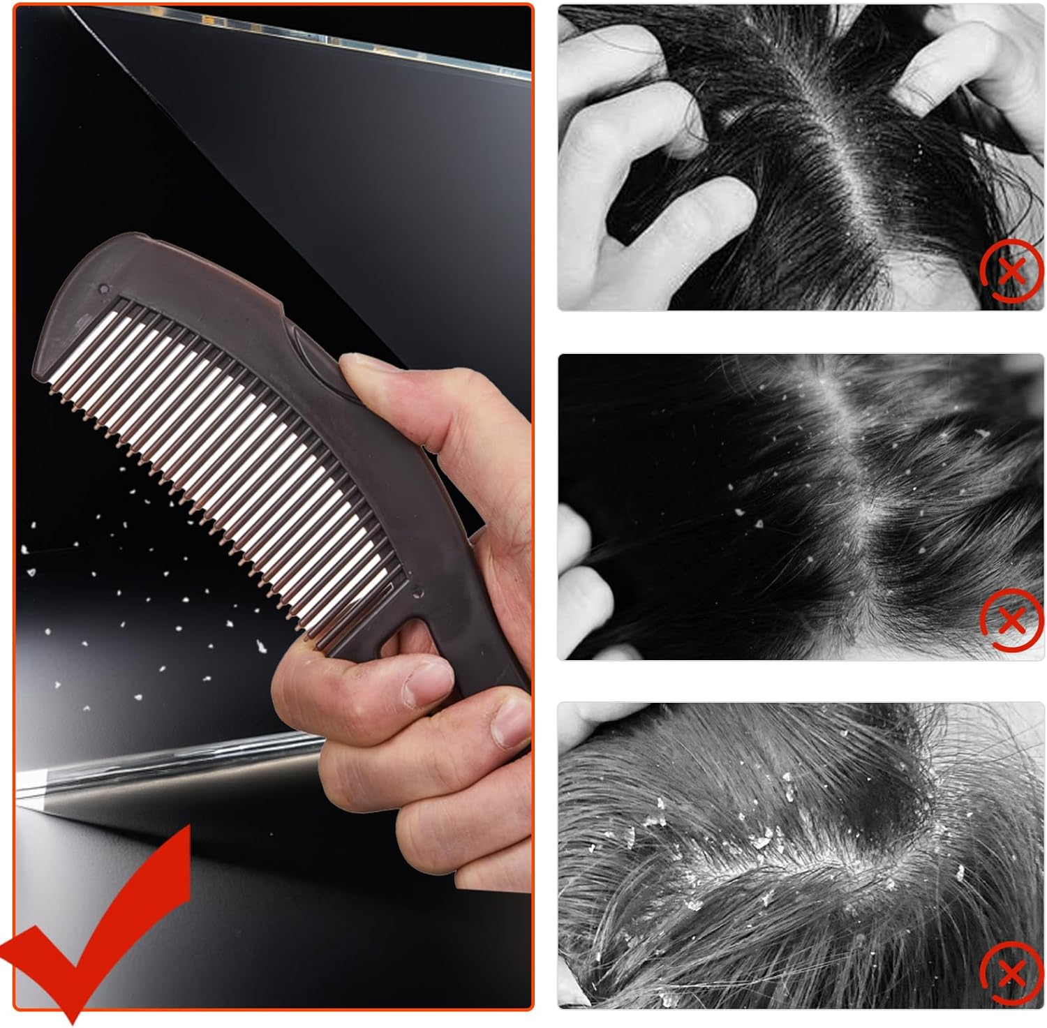 Dandruff Comb, Stainless Steel Fine Tooth Comb, Scalp Psoriasis Comb, Dandruff Remover Comb Scalp Sweep Detoxing Comb, Lice Comb for Scalp Massage Combs for Women Men, Set of 3