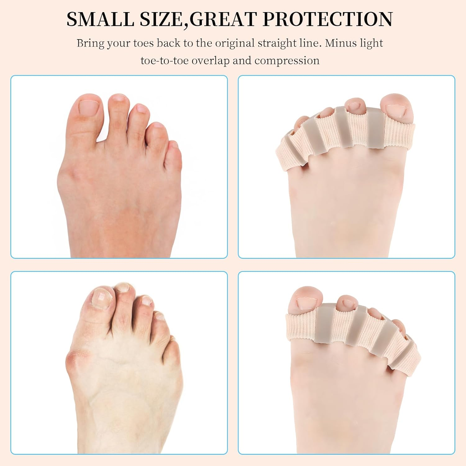 2 Pcs Gel Toe Separator, Tube Bandages, Silicone Toe Stretcher, Hallux Valgus Correction, Gel Big Toe Spacer with 5 Loops, Double Hole Toe Orthosis for Bunion Pain and Overlapping Toes, Women and Men (5 Toes * 2) image number 6