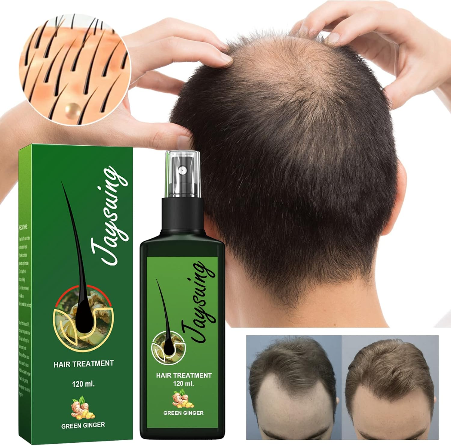 Green Ginger Hair Treatment Spray, 120Ml image number 6