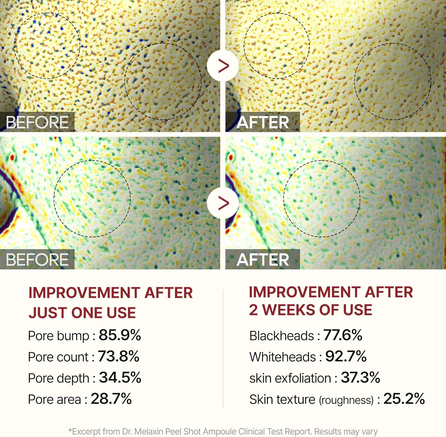 Dr.Melaxin Peel Shot Glow Black Rice Peeling Ampoule, Soft Exfoliating Face and Body Scrub Dead Skin Cells, Blackheads Remover for All Skin Types Korean Skin Care 80Ml image number 1