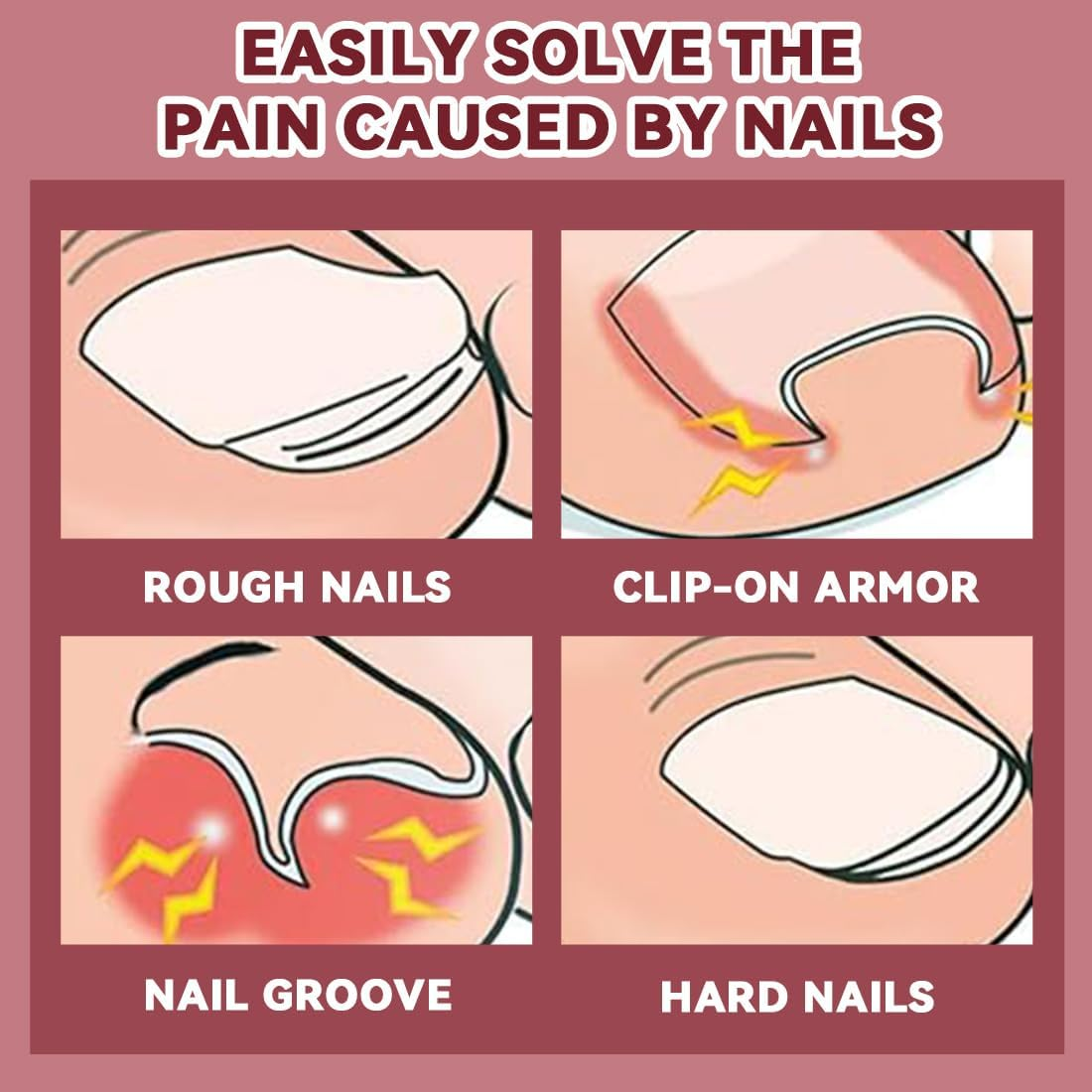 IEBTAWN 1 X Nail Scissors for Deep Ingrown Toenails Made of Stainless Steel for Thick and Fungal Infestation Nail Clippers the Eagle Beak Design Allows Easy, Deep Cutting of Nails image number 2