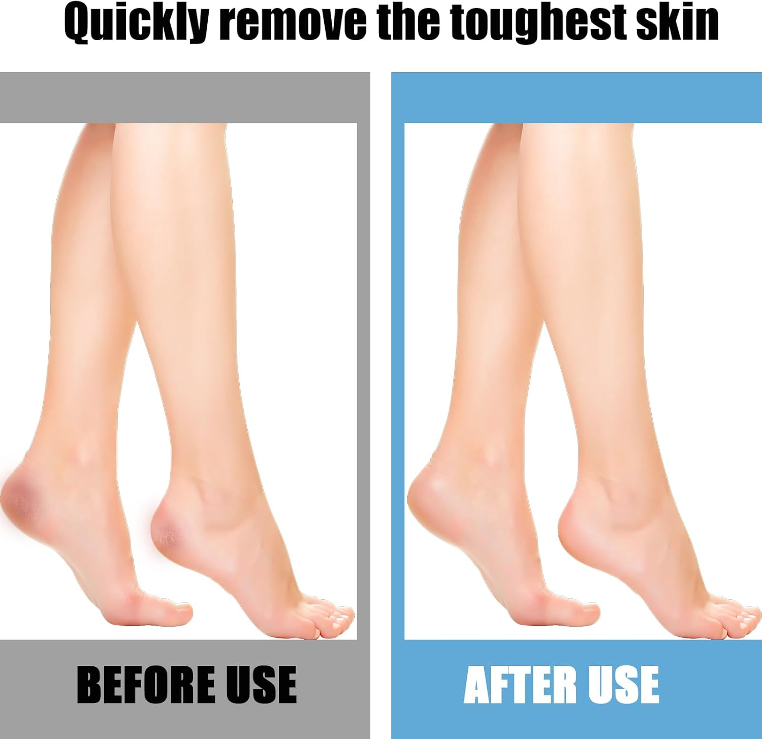 Pack of 10 Replacement Rollers, Callus Remover, Callus Remover Replacement Rolls, Velvet Smooth Rolls, 3 Types of Roughness Coarse for Removing Hard Skin, Pedicure Foot Care Set (Black) image number 1