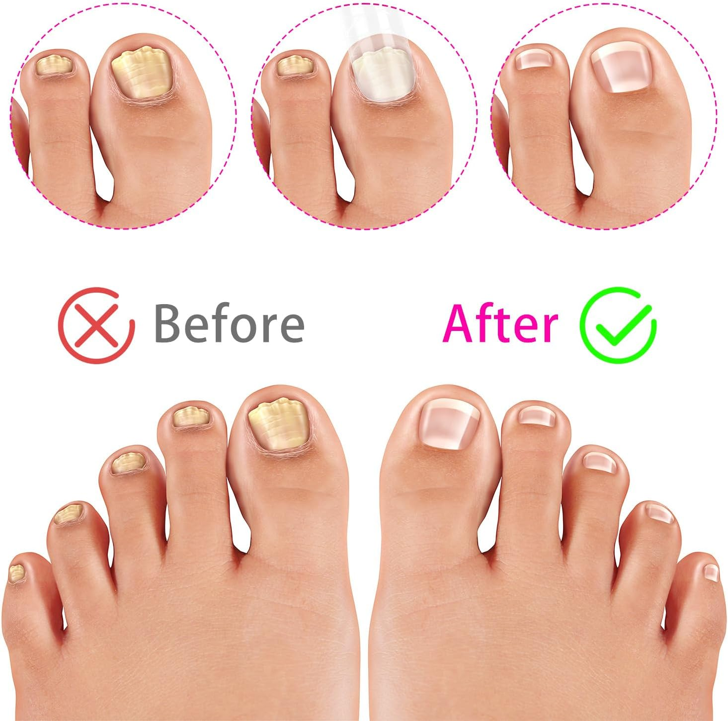 BOXOB 120Pcs Polygel Toenail Forms Kit, 12 Sizes Reusable Toe Dual Forms Nail Extension Molds Full Cover Press on Toe Nail Tips for DIY Home Pedicure & Salon Use(Transparent) image number 5