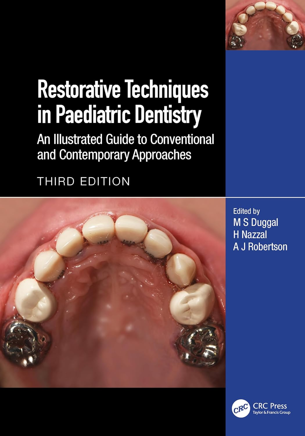 Restorative Techniques in Paediatric Dentistry: an Illustrated Guide to Conventional and Contemporary Approaches