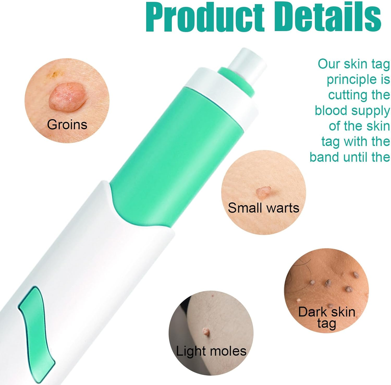 Skin Tag Remover Pen, 2-In-1 Standard Wart Remover, Skin Tag Removal, with 36 Repair Patches and Wet Wipes, Small Rubber Ring Suitable for Skin Tags Ranging from 1 Mm to 4 Mm in Size image number 5