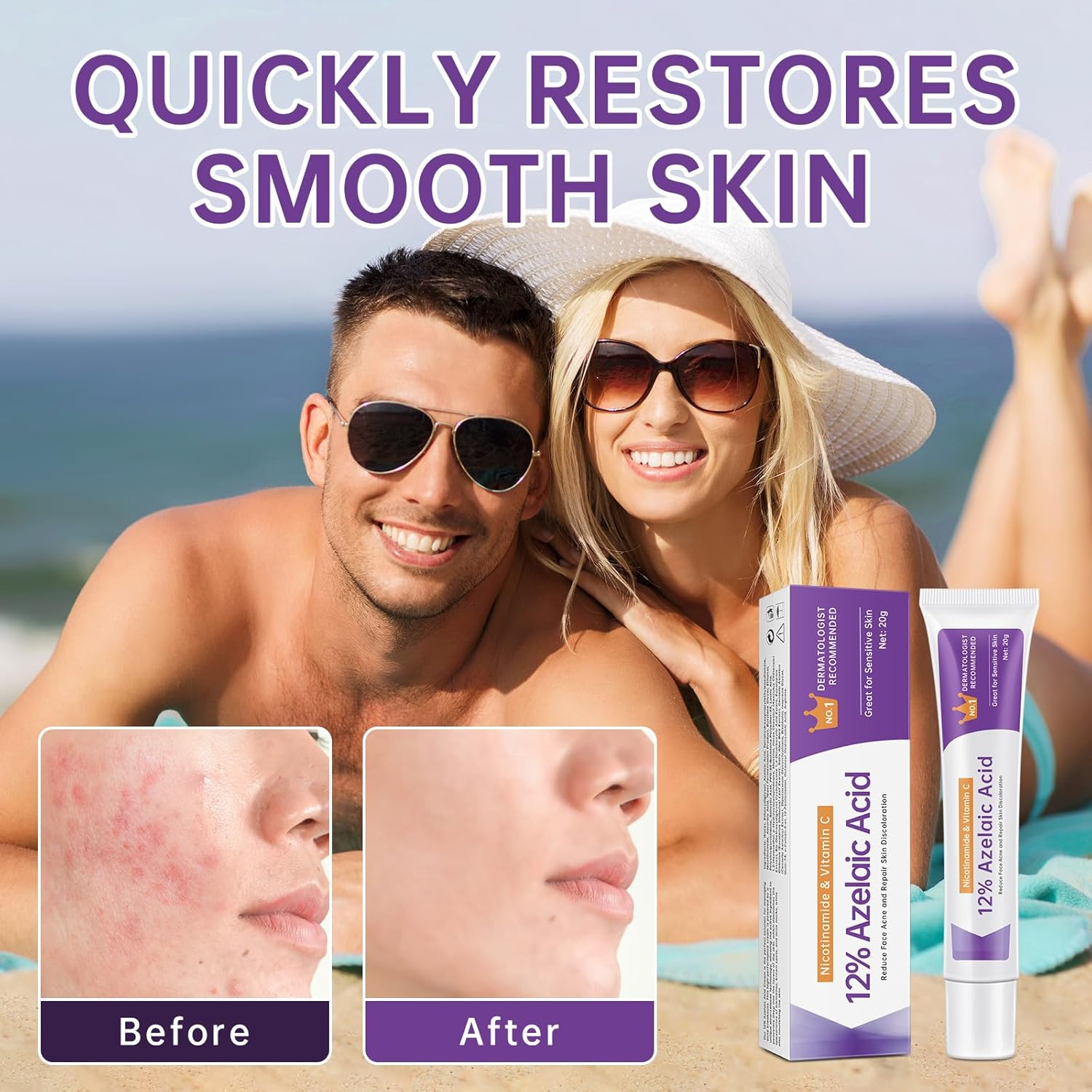 Azelaic Acid 12% Serum for Acne, Azelaic Acid Cream for Acne, Blemishes and Pimples, Nicotinamide Serum Balances Excess Sebum for Smooth Skin, 0.7 OZ image number 1