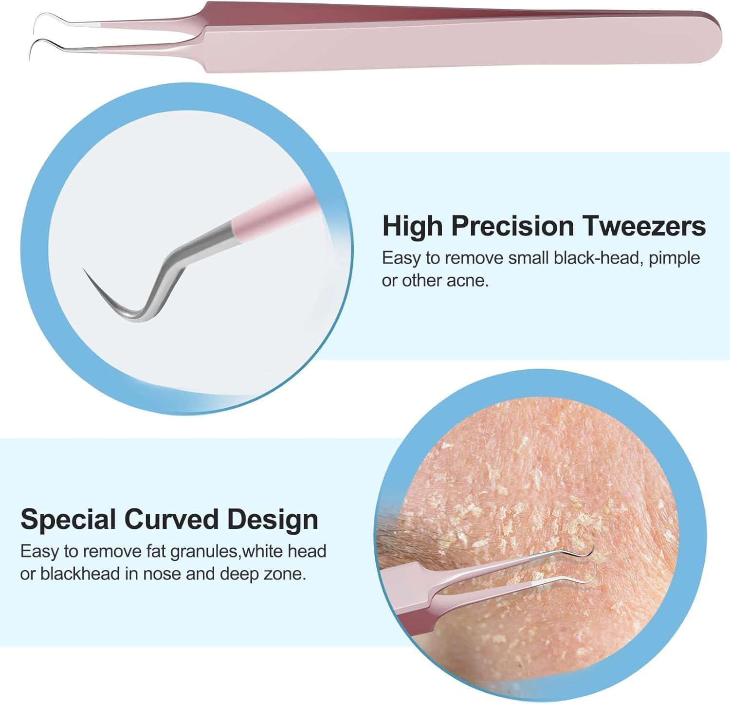 5 PCS Pimple Popper Tool Kit Blackhead Remover Tools, Acne Tools, Black Head Remover for Face, Risk Free Treatment Pimple Extractor with Tweezers,Premium Stainless Steel image number 1