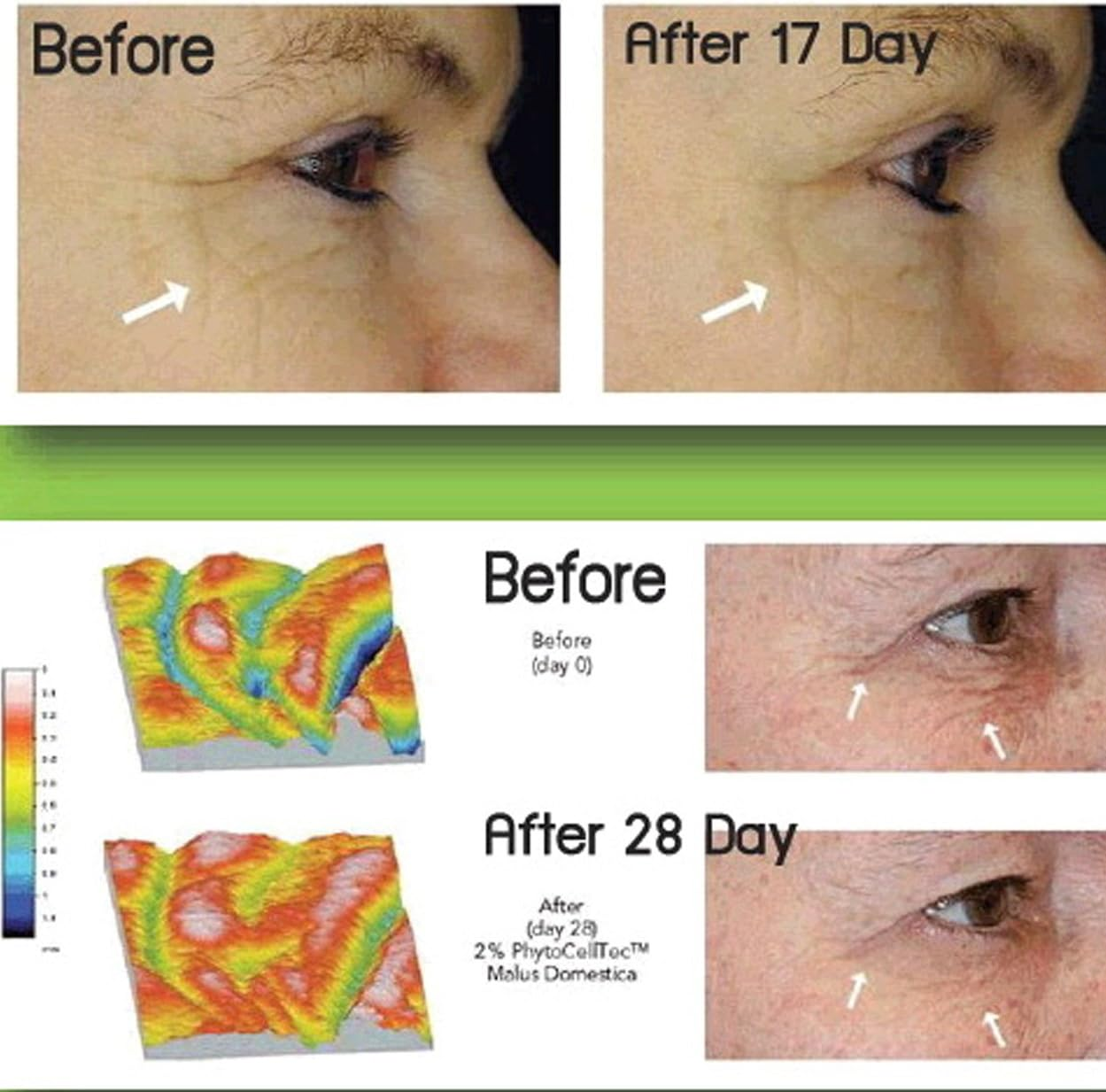 Anti-Ageing. DIY Swiss Apple Stem Cell 100% Serum Booster. Remove Wrinkles, Rebuild Collagen & Elastin image number 5