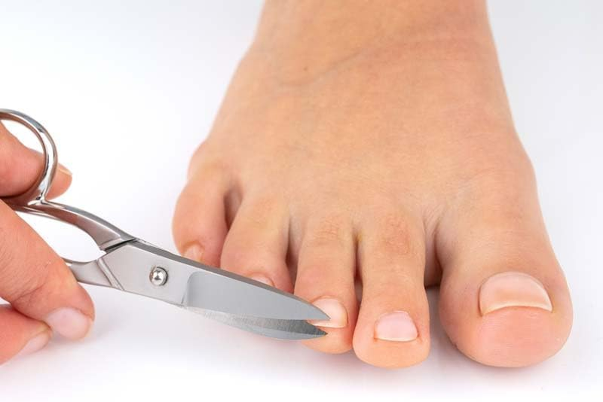 Remos Toenail Scissors Stainless Steel Serrated Blade Cuts Strong Fingernails and Toenails image number 4