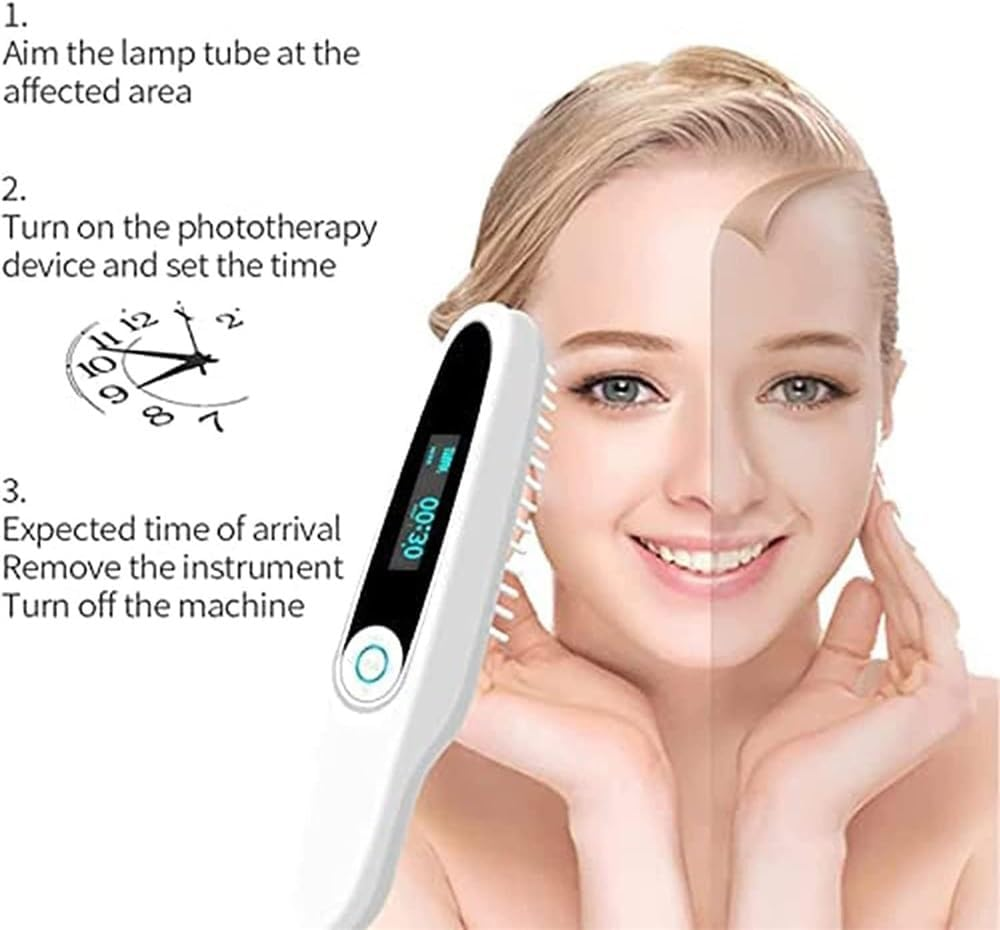 Ultraviolet Phototherapy Lamp,Uvb Light Therapy Home UV Phototherapy LCD Display Intelligent Controller Home Use Uvb Therapy Lamp for Skin,Body & Scalp,Include Goggle image number 3