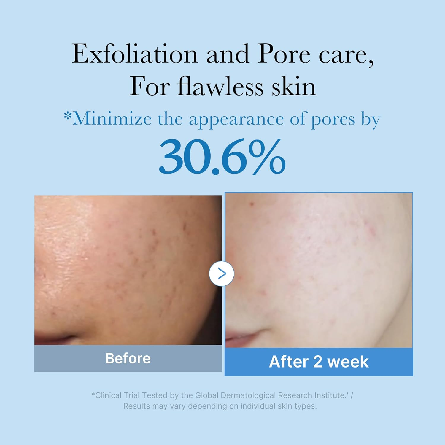 MEDICUBE - Zero Pore Toner 250Ml image number 3