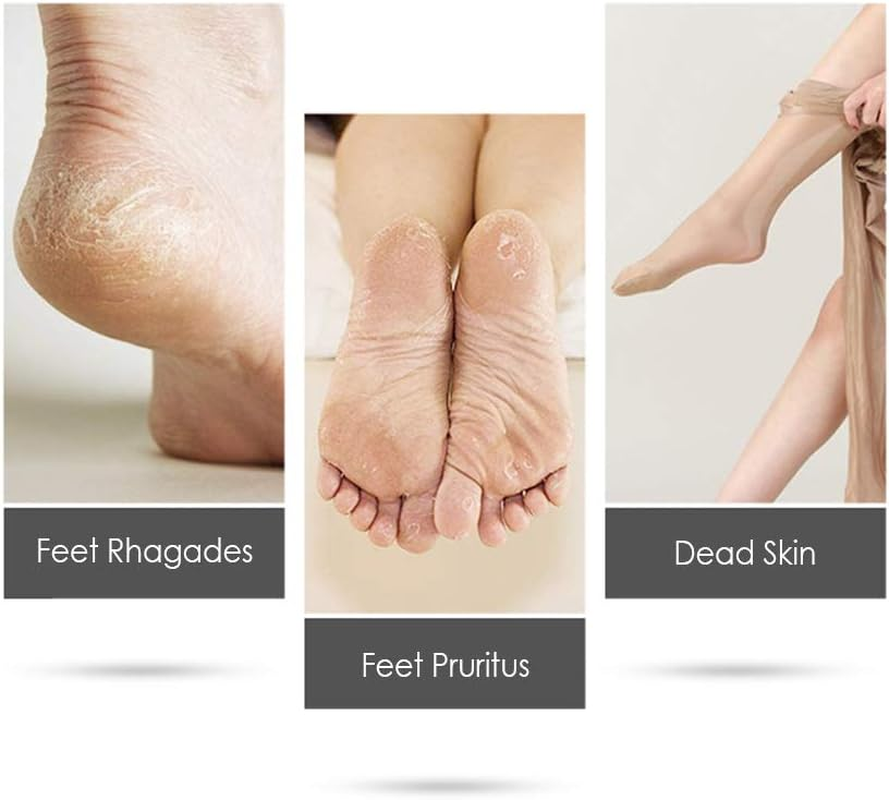 Yasao Electric Foot Grinder with Roller Head Battery Powered Portable Feet File Pedicure Tool Foot Scrubber Callus Remover for Dead Hard Cracked Dry Skin