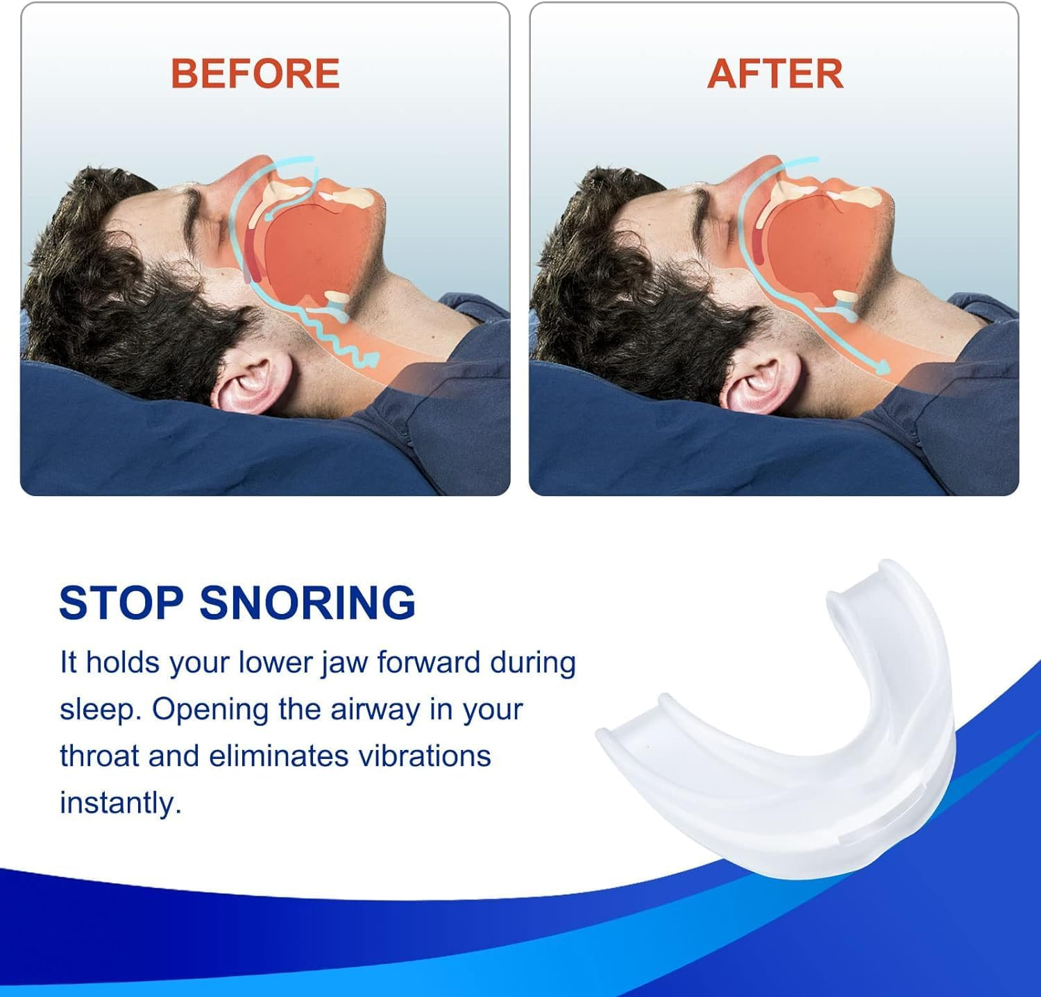 LGLAU Anti-Snoring Mouth Guard, Anti-Snoring Mouthpiece, Comfortable Anti-Snoring Devices for Men/Women a Better Night'S Sleep image number 3