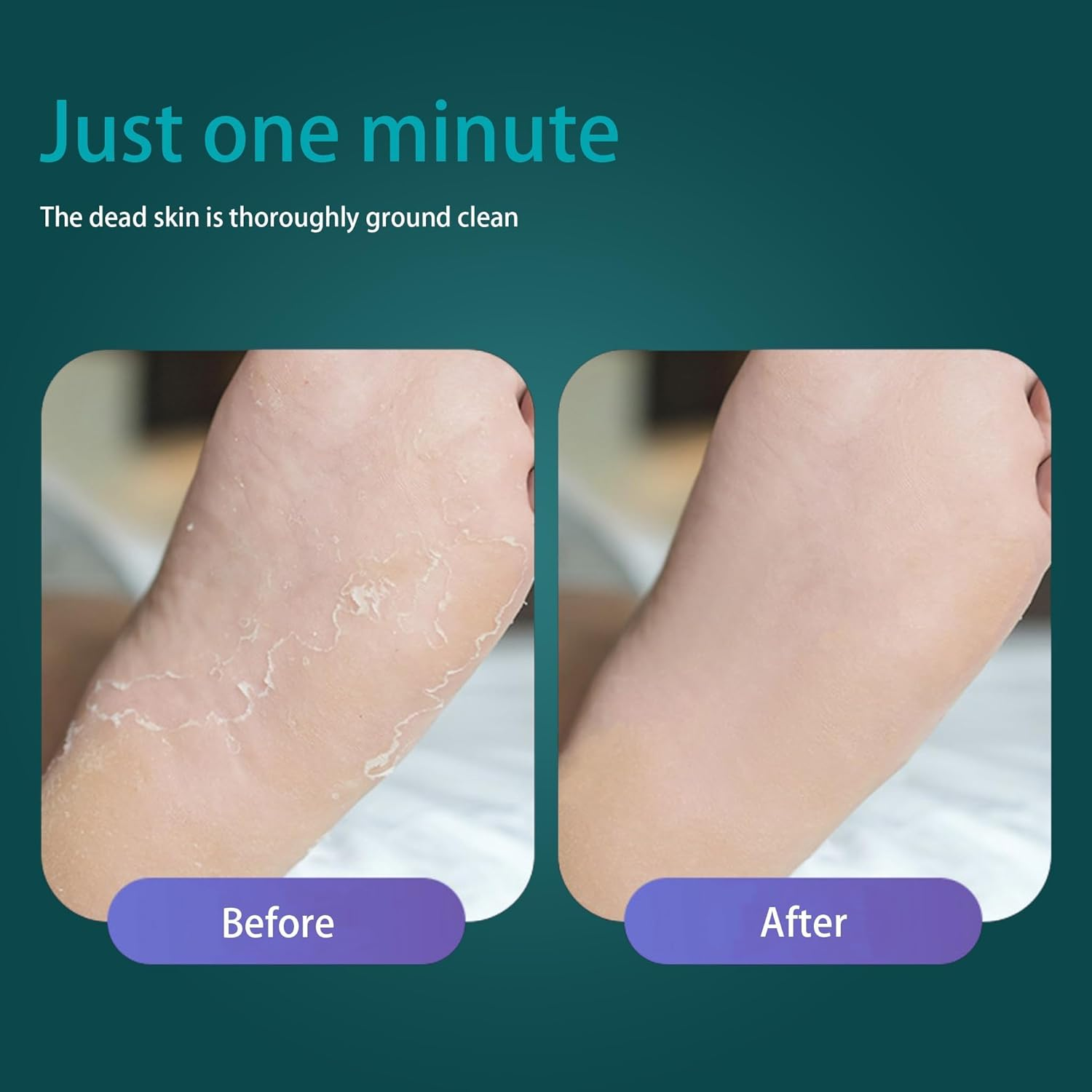 Yxvyxymyxxg​ Foot File and Callus Remover with Dead Skin Catcher - Professional Heel Scraper for Wet/Dry Use, Mess-Free Pedicure Tool for Cracked Heels image number 4