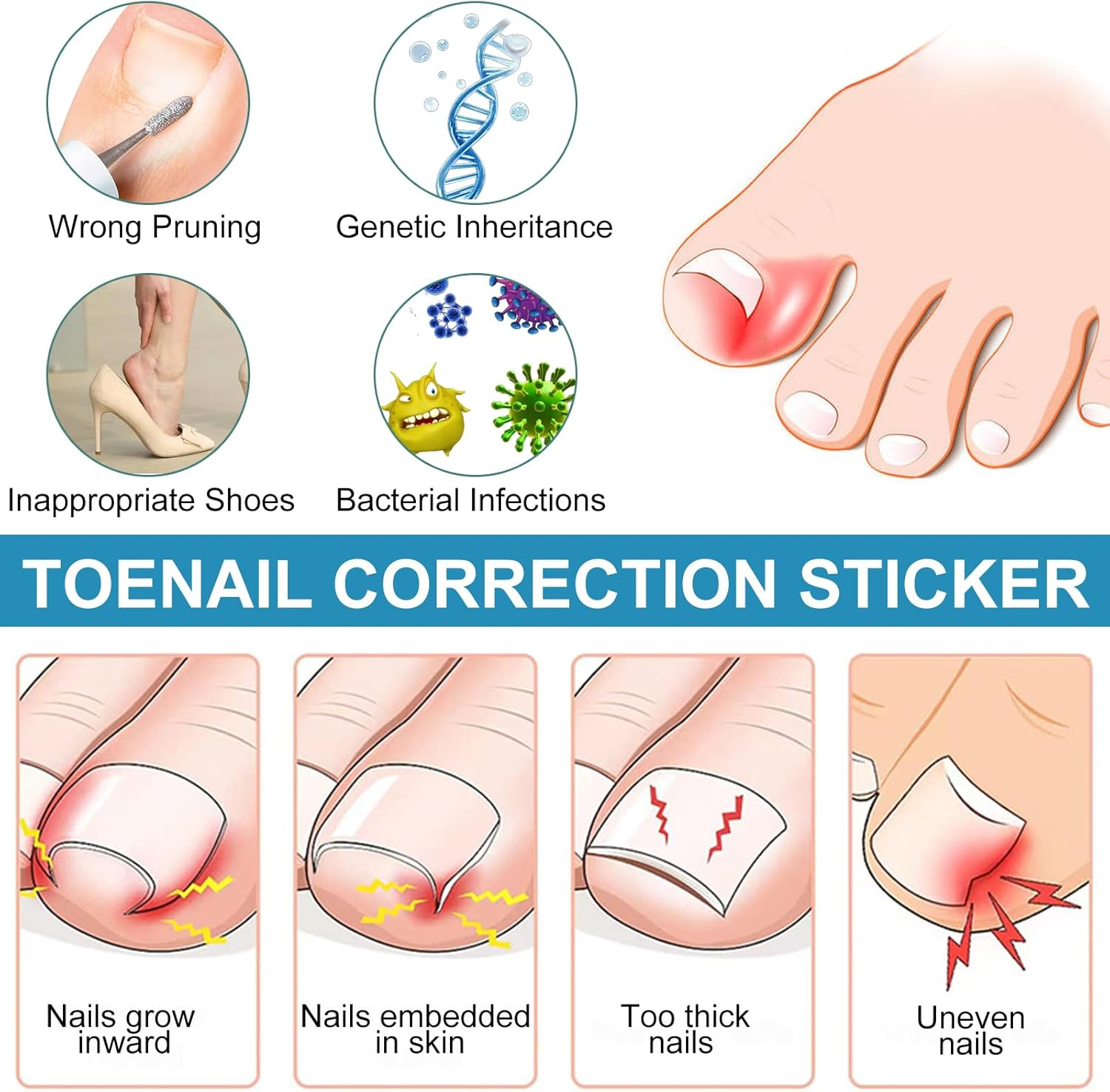 50Pcs Ingrown Toenail Care Strips &ndash; Plant-Based Toenail Support, Rapid Soothing & Comfort Boost, Natural Growth Encouragement, Breathable Design & Easy Application for Daily Use