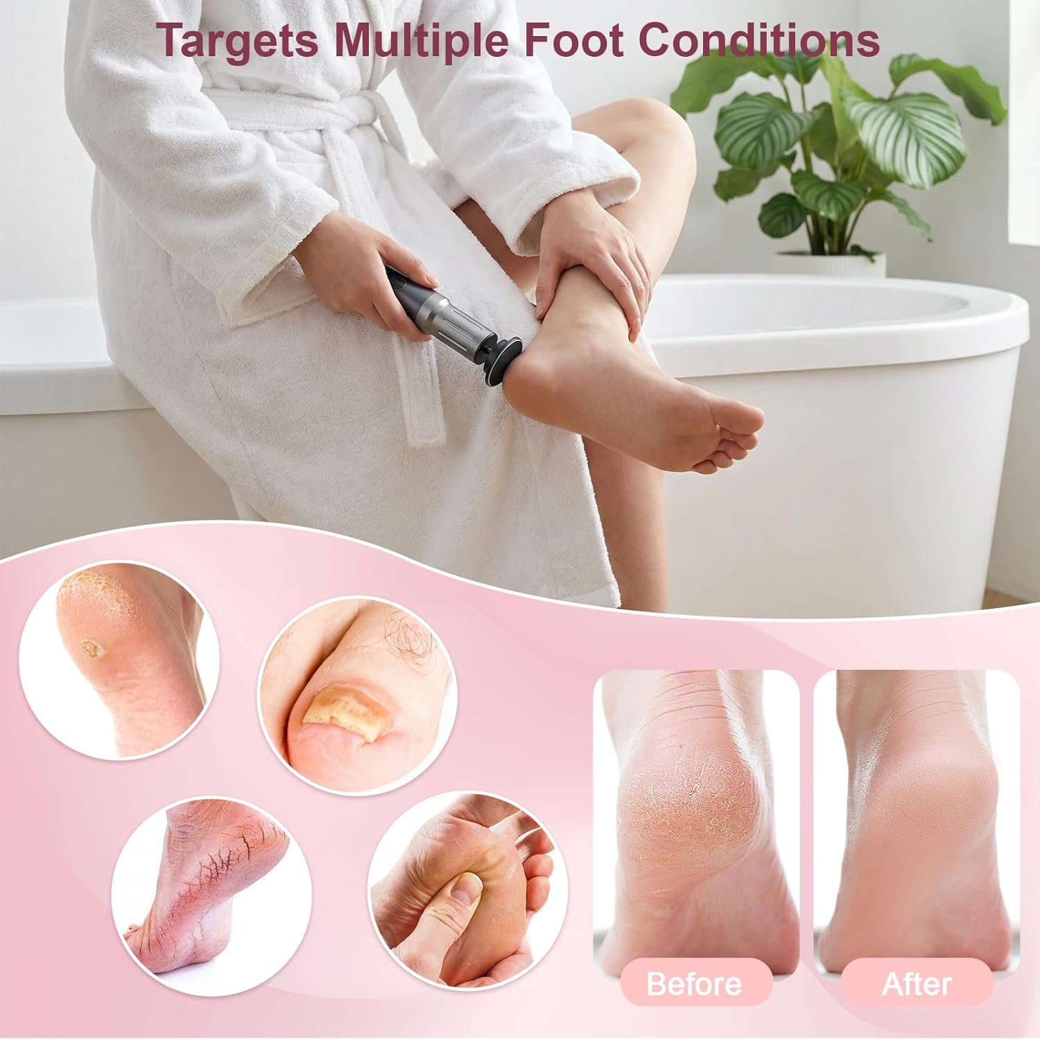 Glovios Electric Callus Remover with LED Display, 2 in 1 Professional Callus Remover Set with Foot Files and Nail Polisher, 6 Speeds, Foot Care Set for Dead Hard Skin