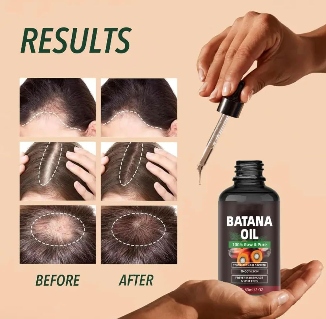 Batana Oil for Hair &ndash; Natural & Unrefined | Deeply Nourishes Scalp & Moisturizes Hair | Perfect for Dry, Brittle, or Damaged Hair | 60Ml image number 4