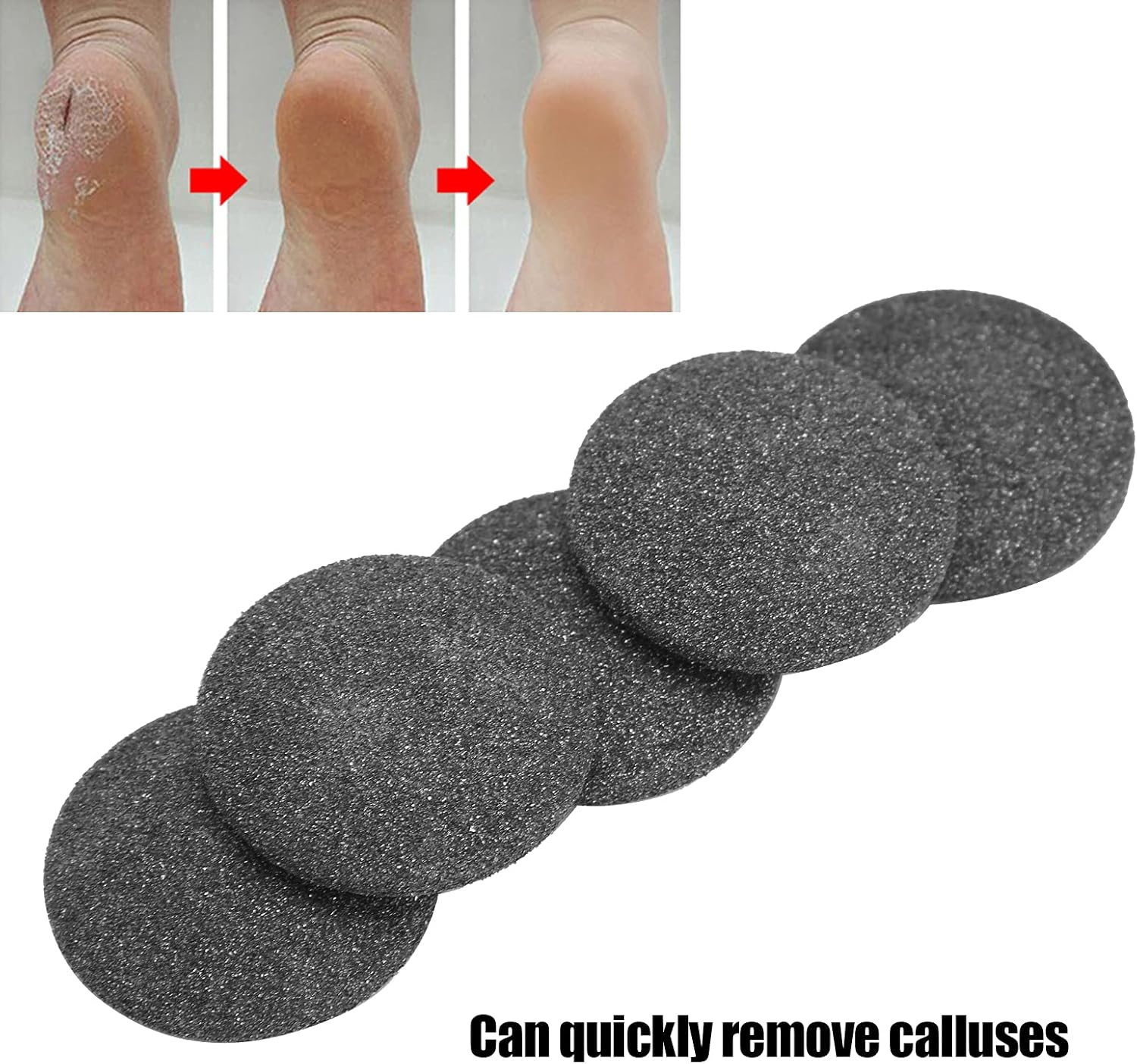 Watris Veiyi Replacement Sandpaper Discs, Pack of 5 Callus Remover Hard Skin Replacement Foot Grinding Head Tool for Dead Skin Callus Remover Head Foot Files (Black) image number 6