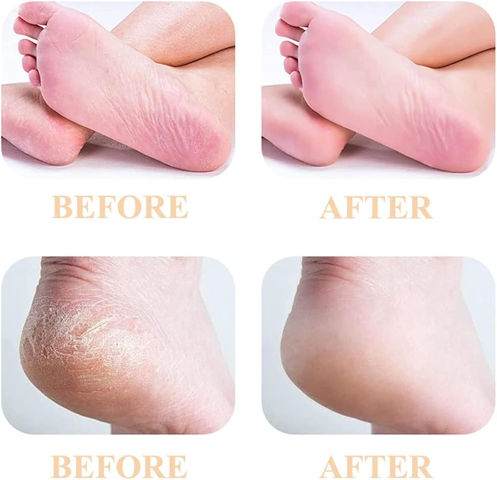 PAI4LEISI 6 Coarse Pedicures Replacement Heads for Flawless Pedi Electric Tool Foot File,Pedi Replacement Roller Head Fit Finishing Touch Flawless Pedi as Seen on TV image number 5