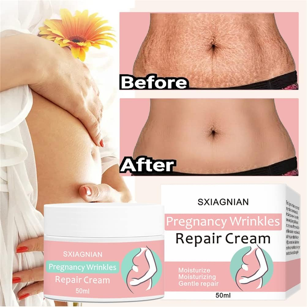 Organic Flawless Firming Cream Stretch Marks Fading Cream Stretch Marks Reversal Cream Stretch Marks Remover Cream Skin Care Treatment Cream for Stretch Mark Removal Maternity Slackline image number 2