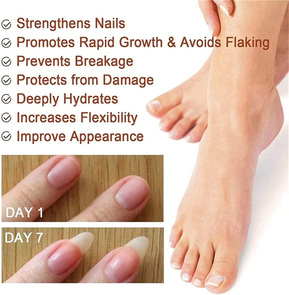 7 Days Nail Growth and Strengthening Serum, 20Ml Nail Growth and Strength Serum, Nail Growth & Strengthening Oil Serum, Stronger Nails in 1 Week Nail Strengthening Treatment (1Pcs) - 1Pcs image number 2