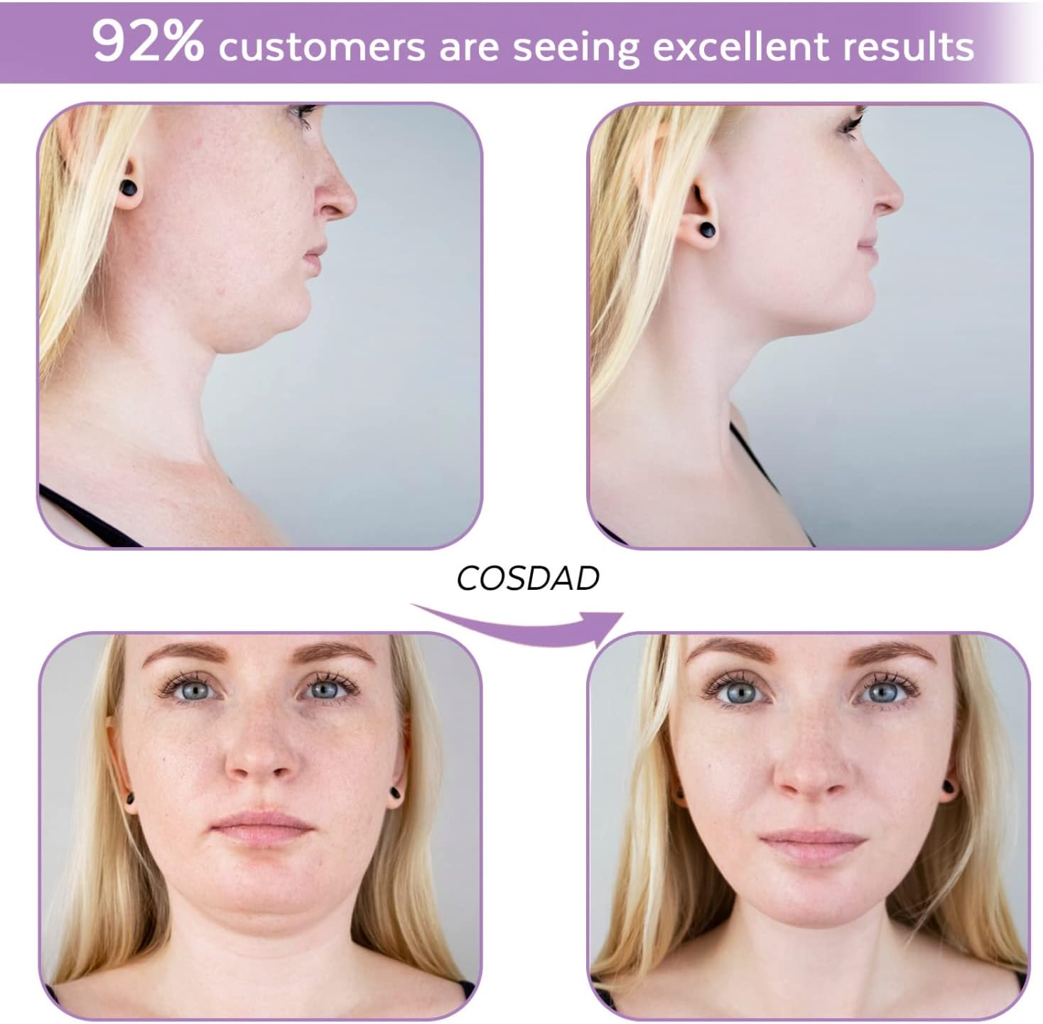 COSDAD Reusable Double Chin Reducer Chin Strap Face Slimming Strap Face Slimmer Shaper for Women,Breathable Comfortable V Line Lifting Mask,Innovative Lifting Technology,One Fits All,Purple