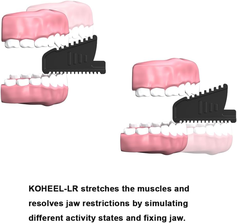 KOHEEL LR Jaw Relief Device for TMJ Pain, Jaw Tension, Teeth Grinding & Clenching, Headaches, and Limited Jaw Mobility &ndash; Passive Stretching Solution for Jaw Muscle Relaxation (1 Pack) image number 2