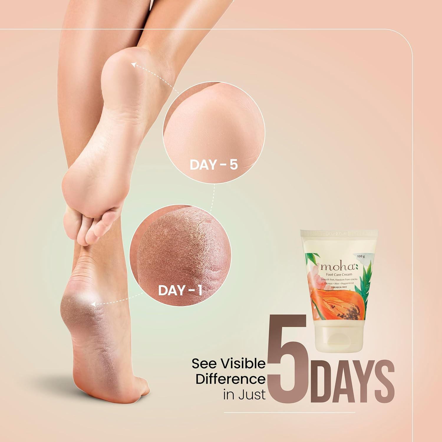 Moha: Foot Cream for Rough, Dry and Cracked Heel, Feet Cream for Heel Repair with Benefits of Aleovera, Papaya & Peppermint (200 Gram) image number 1