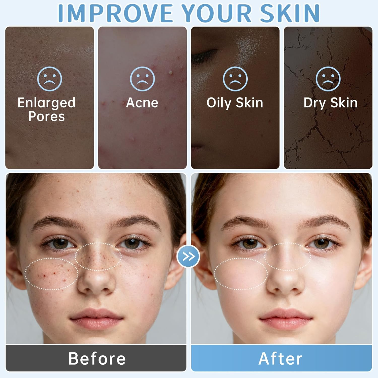 Skin Care Routine Set for Girls, anti Aging Milk Skin Care Set with Cleanser, Serum, Cream, Eye Cream for Acne, Shrink Pores, Face Skincare Travel Kit with Hyaluronic Acid for Women, Daily Care image number 4