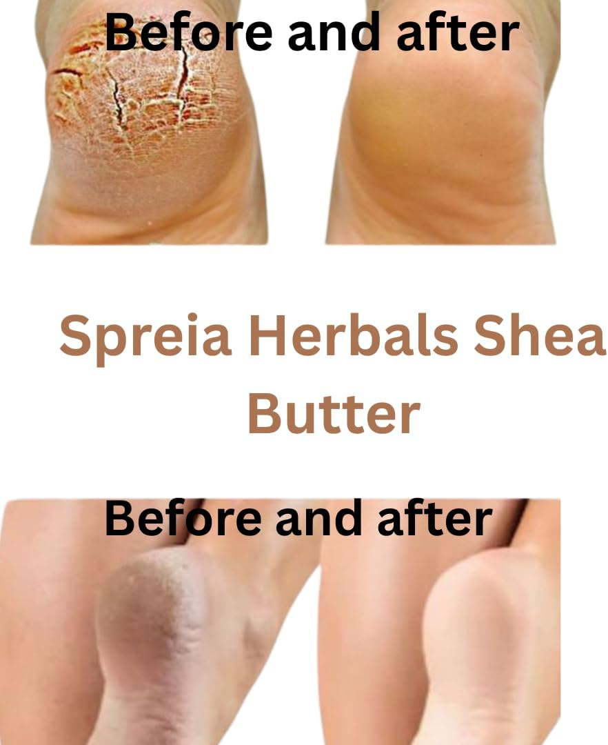 Spriea Herbals Pure Original Natural Shea Body Butter for Smooth Skin & Firms Stretch Marks(Pack of 1, 200 Gm) image number 5