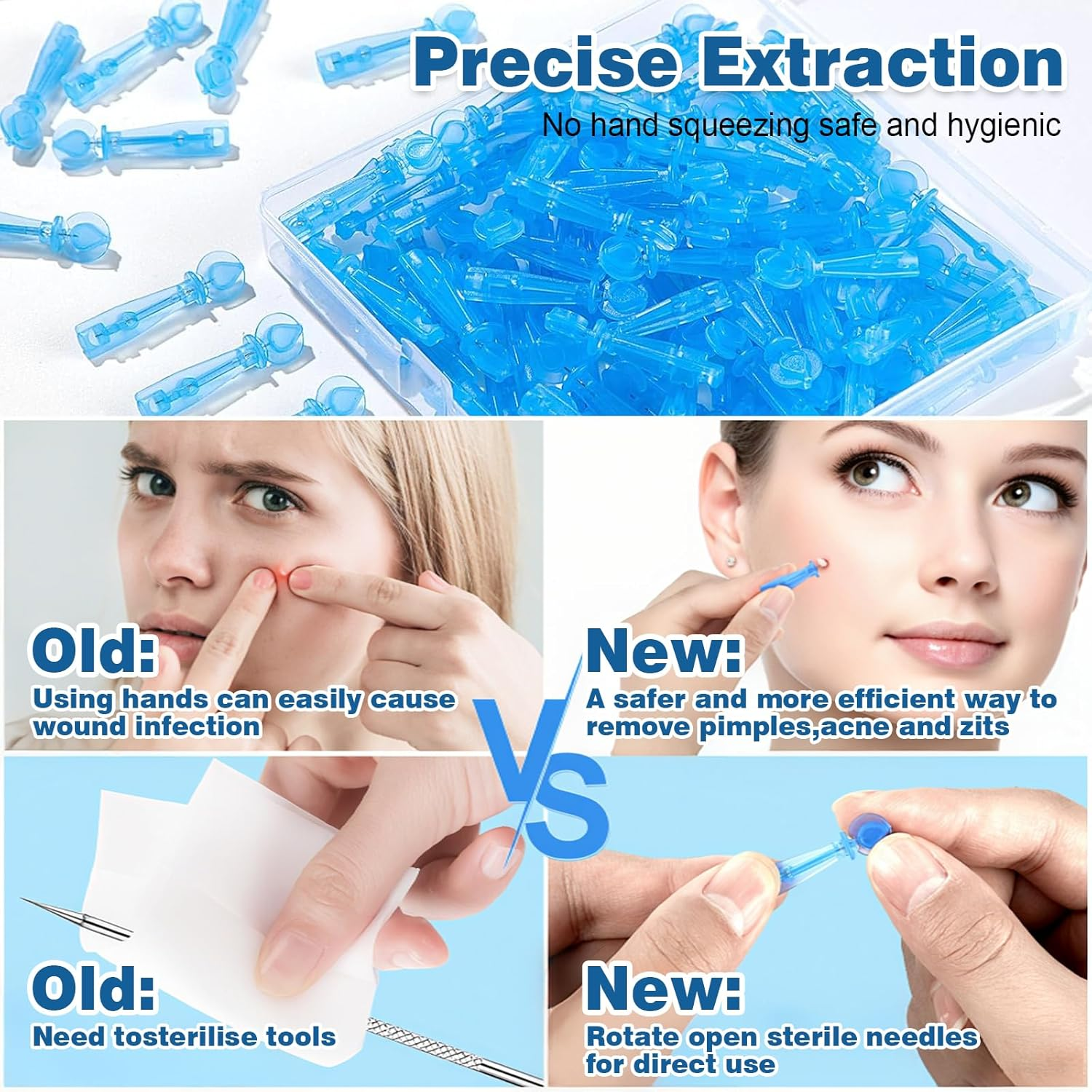 Sterile Acne Needles 100Pcs - 0.01Mm Ultra Fine Needle Tip, Stainless Steel Blackhead Extractor for Painless Acne Removal