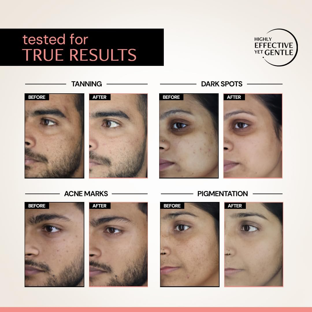 Deconstruct Clearing Serum 2% Alpha Arbutin + 5% Niacinamide | anti - Pigmentation & Tanning Face Serum | Clears Dark Spots, Marks, Hyperpigmentation | for Both Men & Women | 30Ml image number 4