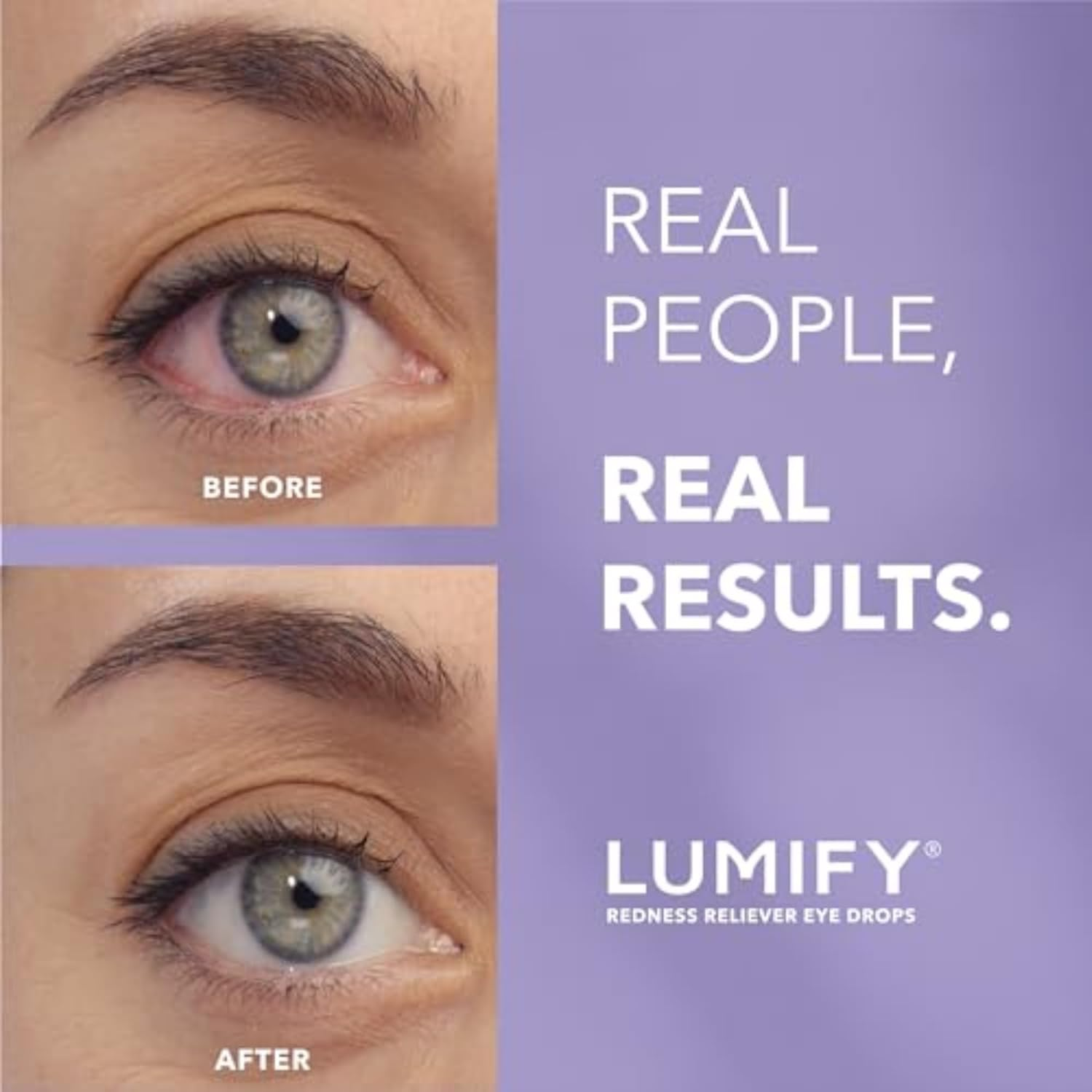 LUMIFY Redness Reliever Eye Drops 0.17 Fl Oz (5 Ml) image number 2