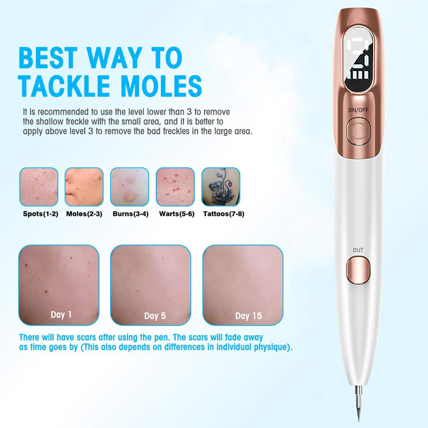 LARALA Skin Tag Remover Kit Plasma Pen for Face & Body, Fast and Easy Removal Pen for Warts, Nevus, Spot, Freckle, Tattoo image number 3