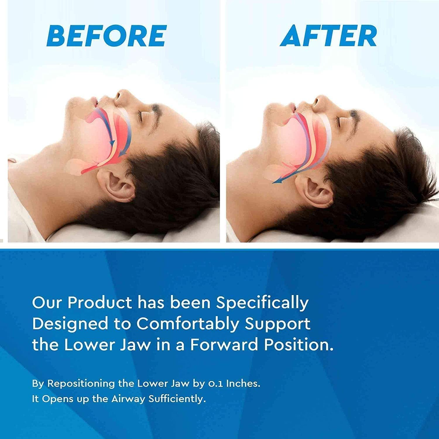 Professional Mouth Guards, Snore Stopper Mouthpiece, anti Snoring Solution Devices Sleep Aid Custom Night Mouth Guard Fit Night Dental Guard image number 2