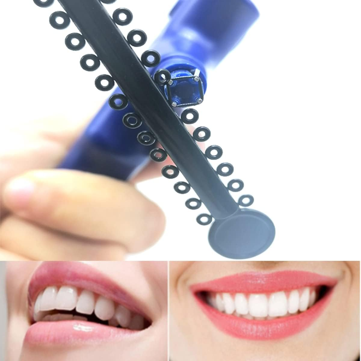 1040 Pcs Black Braces Rubber Bands Orthodontic Ligature Ties O-Rings Elastic Bands for Braces (Black) image number 2